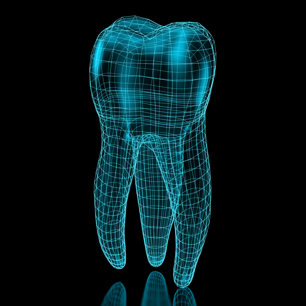 Full Mouth Dental Implants 2020 Guide Omega Dental Houston Tx