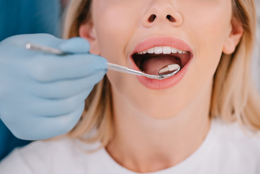 dental cleanings